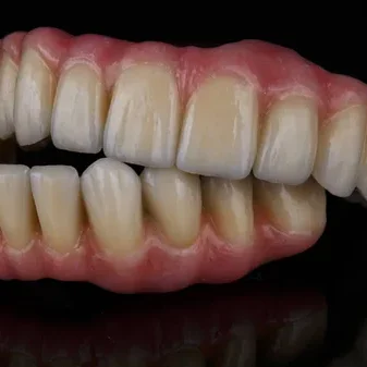 Denture2